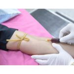 Vad är skillnaden mellan IgE allergitester och IgG allergitester?